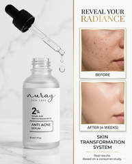 Nuray Anti Acne Serum