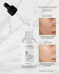 Nuray Hylaronic Serum